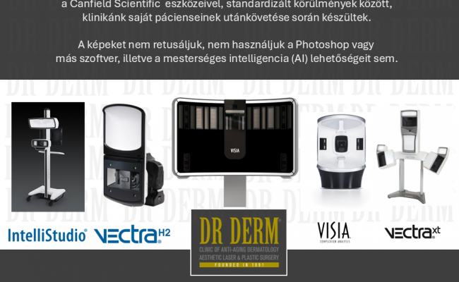 Utolsó dia Canfield diagnosztika