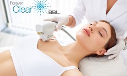 Akne fényterápia ForeverClear BBL