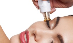 Tempsure EYES szemkörnyék feszesítés