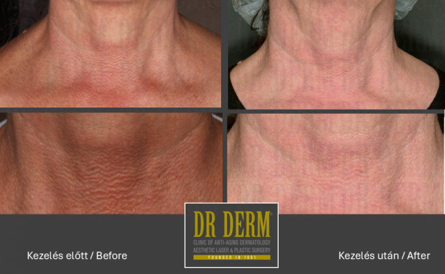 MoveoGlo_Dr Derm 1