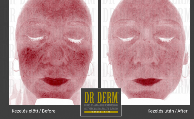 MoveoGlo_Dr Derm 2