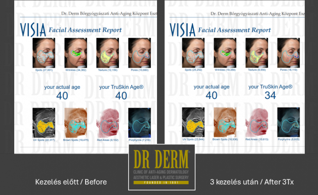 MoveoGlo_Dr Derm 4