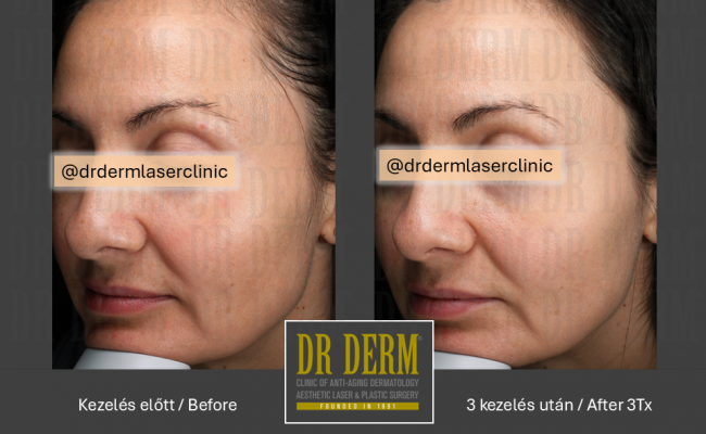 MoveoGlo_Dr Derm 5