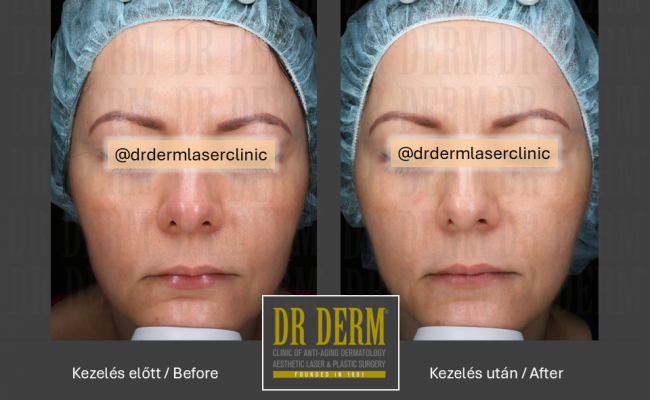 MoveoGlo_Dr Derm 6