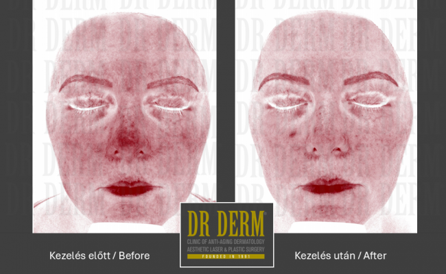 MoveoGlo_Dr Derm 7