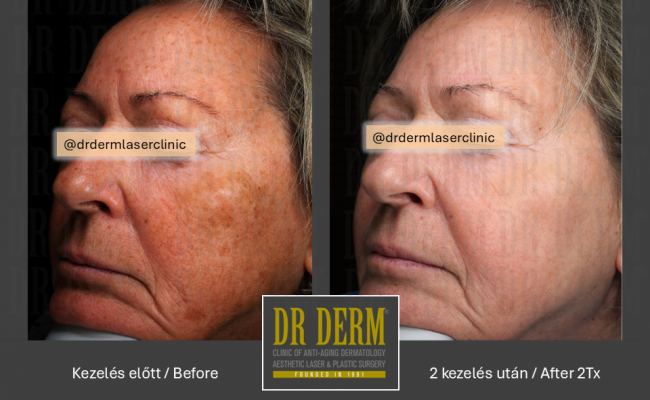 ThreeForMe_Dr Derm Budapest 1