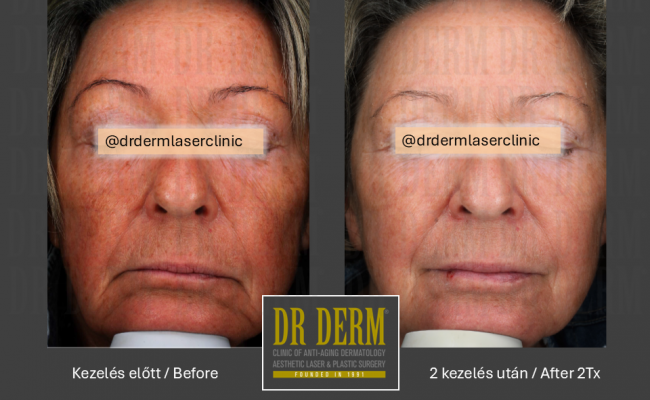 ThreeForMe_Dr Derm Budapest 2