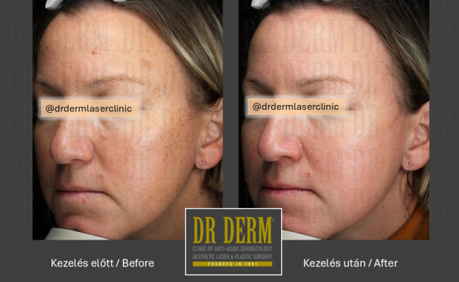 ThreeForMe_Dr Derm Budapest 3