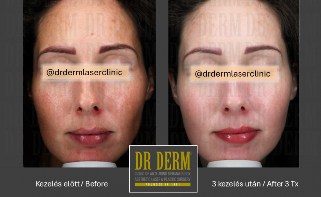 ThreeForMe_Dr Derm Budapest 4