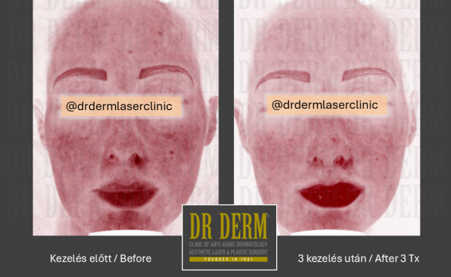ThreeForMe_Dr Derm Budapest 5