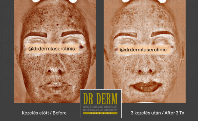 ThreeForMe_Dr Derm Budapest 6