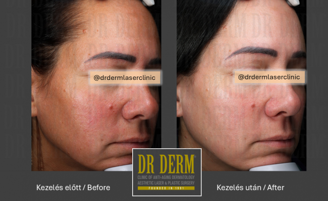 ThreeForMe_Dr Derm Budapest 7