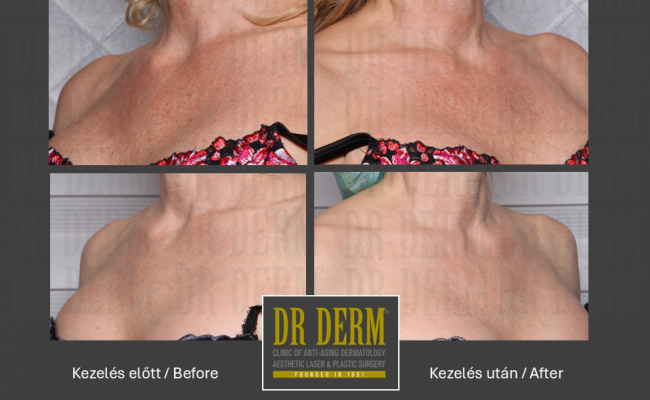ThreeForMe_Dr Derm Budapest 8