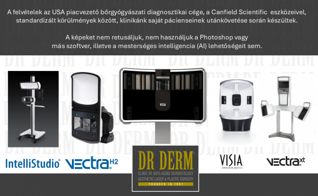 Utolsó dia Canfield diagnosztika