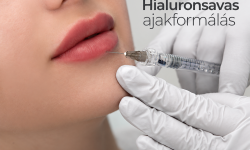 Hialuronsavas ajakformálás