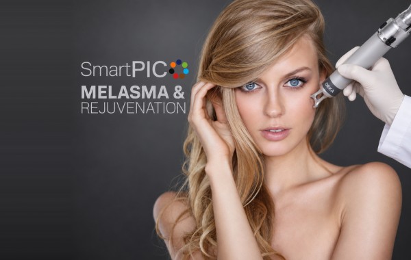 Melasma halványítás SmartPICO lézerrel