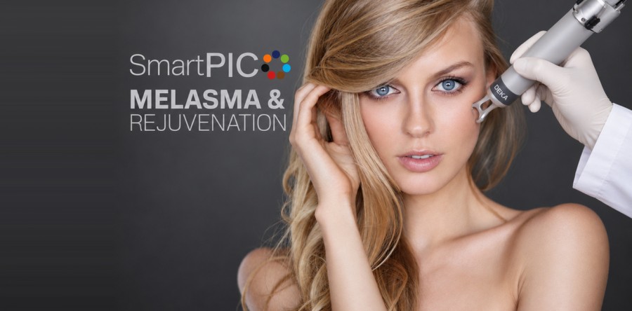 Melasma halványítás SmartPICO lézerrel