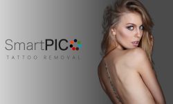 Tetoválás eltávolítás SmartPICO lézerrel
