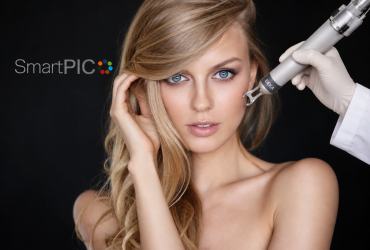 Melasma kezelés LIOB rejuvenációval